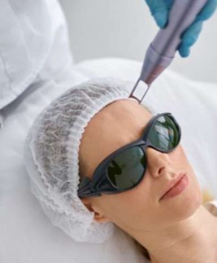 Laser Toning Treatment: Benefits, Side Effects, and Results